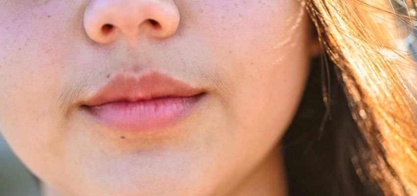 solucion definitiva al hirsutismo como eliminar el vello facial en cara y cuerpo