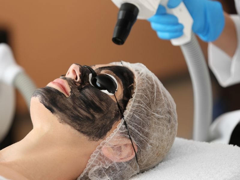 hollywood peel