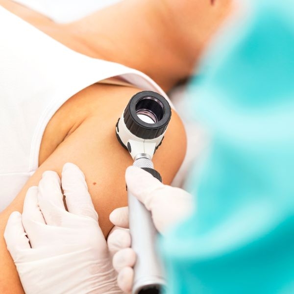 dermatoscopia