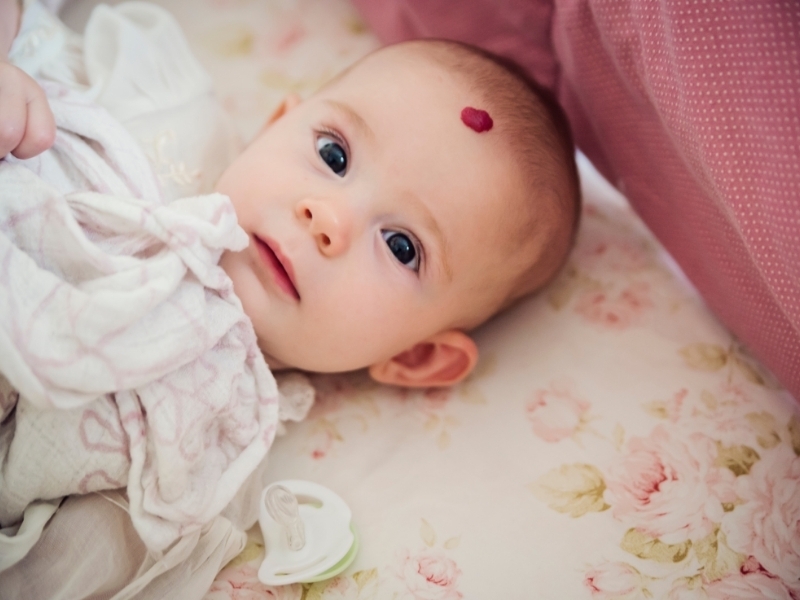 hemangiomas infantiles