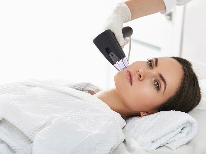 radiofrecuencia facial