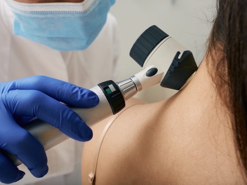 tratamientos dermatologicos avanzados